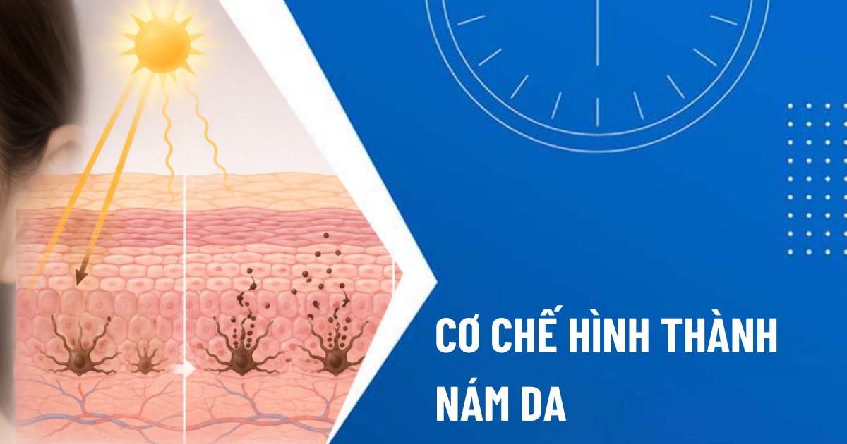 cơ chế hình thành nám