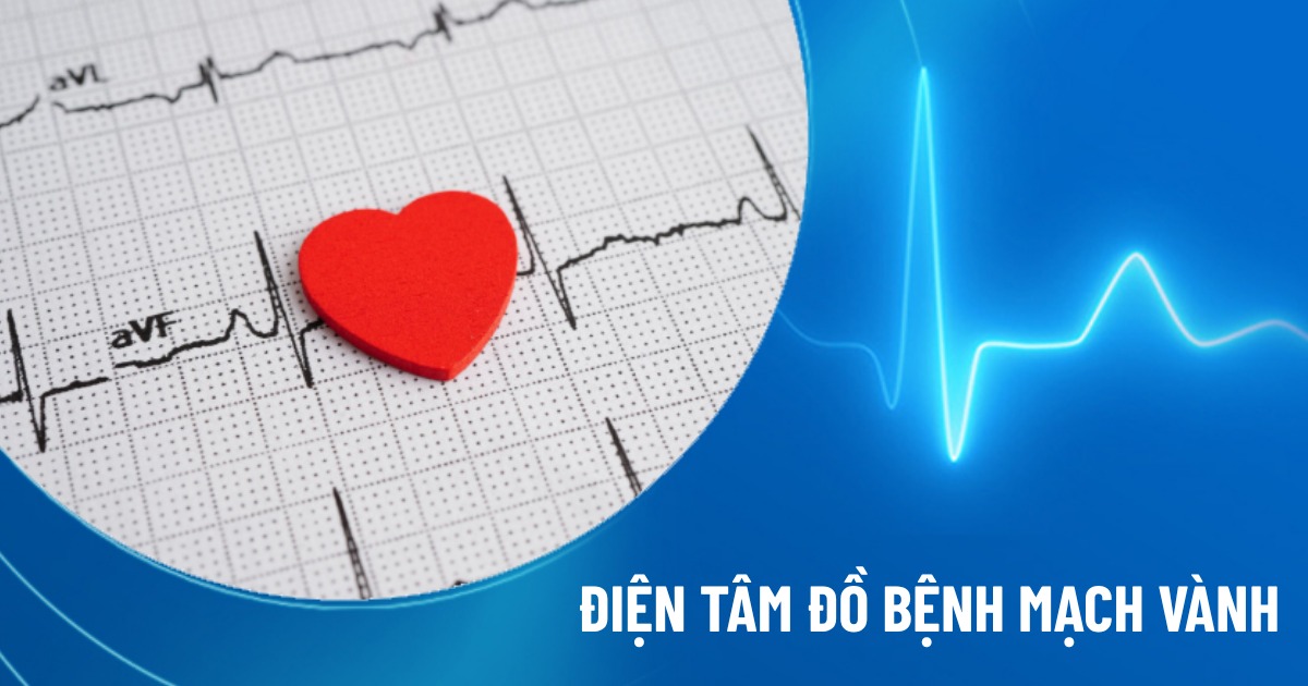 điện tâm đồ bệnh mạch vành