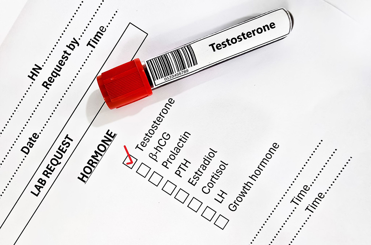định lượng testosterone