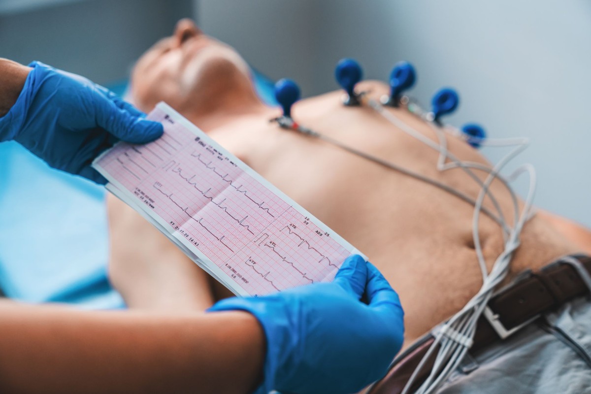 đo ecg