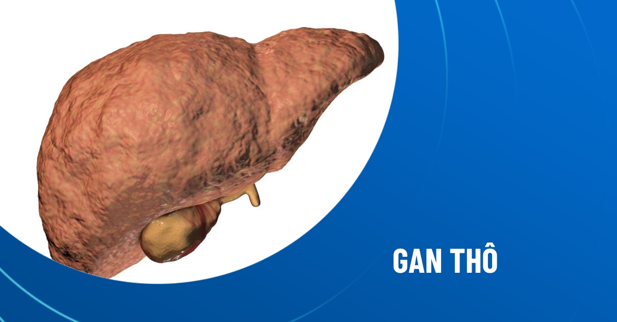 gan thô