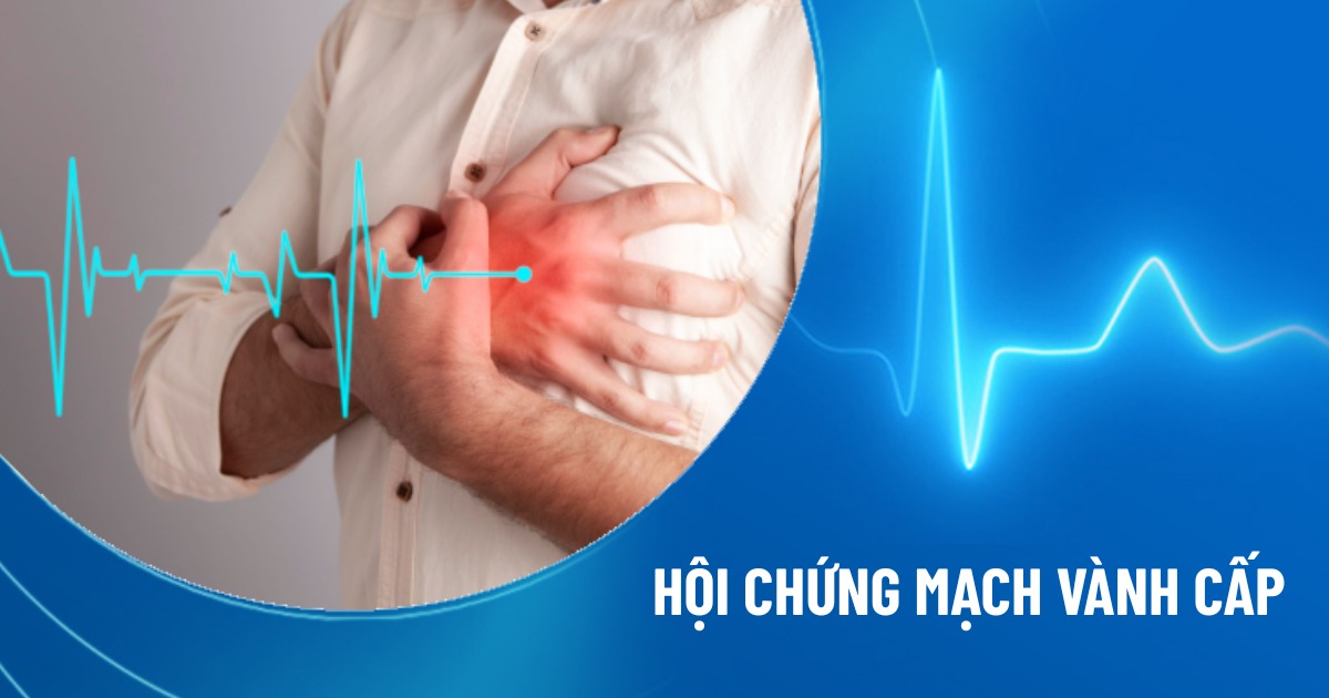 hội chứng mạch vành cấp
