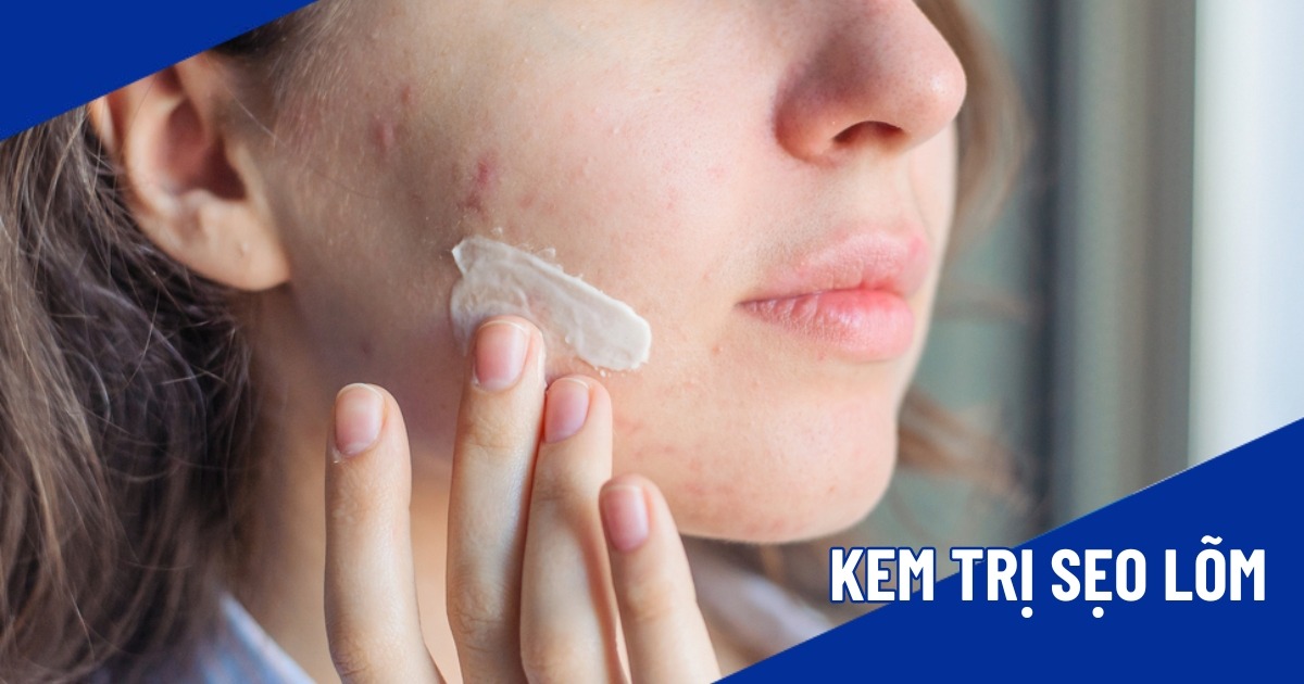 kem trị sẹo lõm