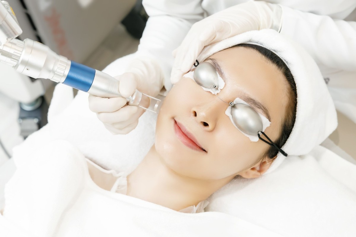 laser làm đẹp da