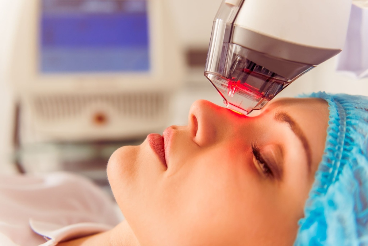 laser trị nám