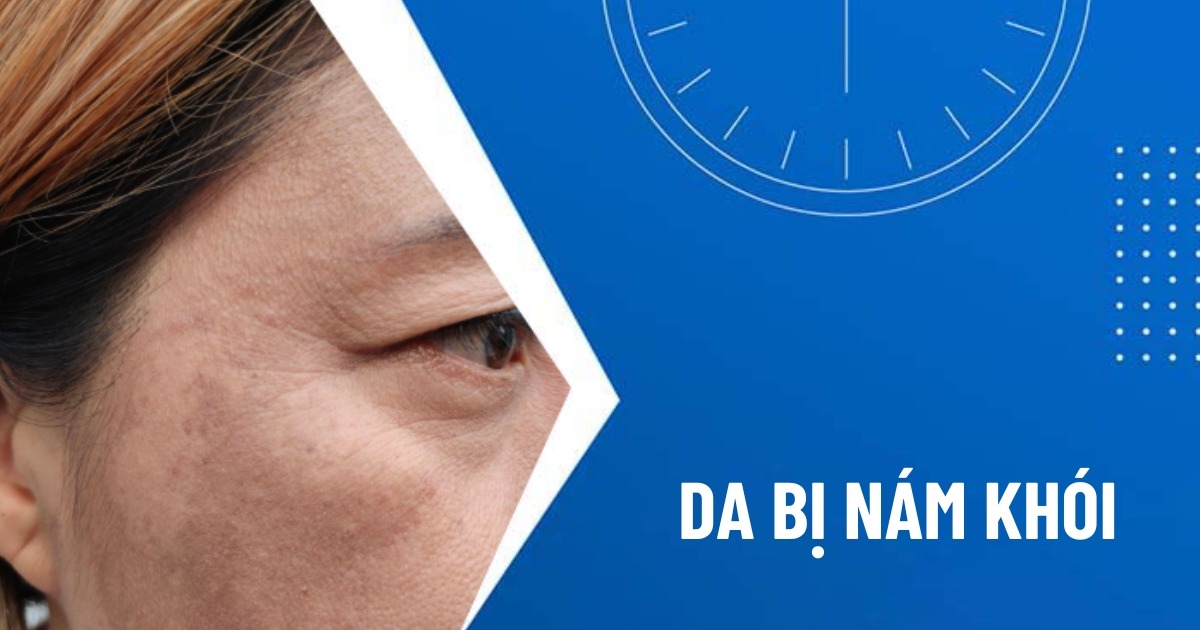 nám khói