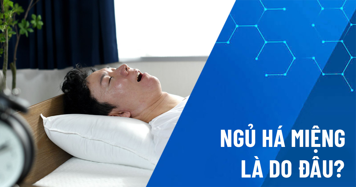 ngủ há miệng