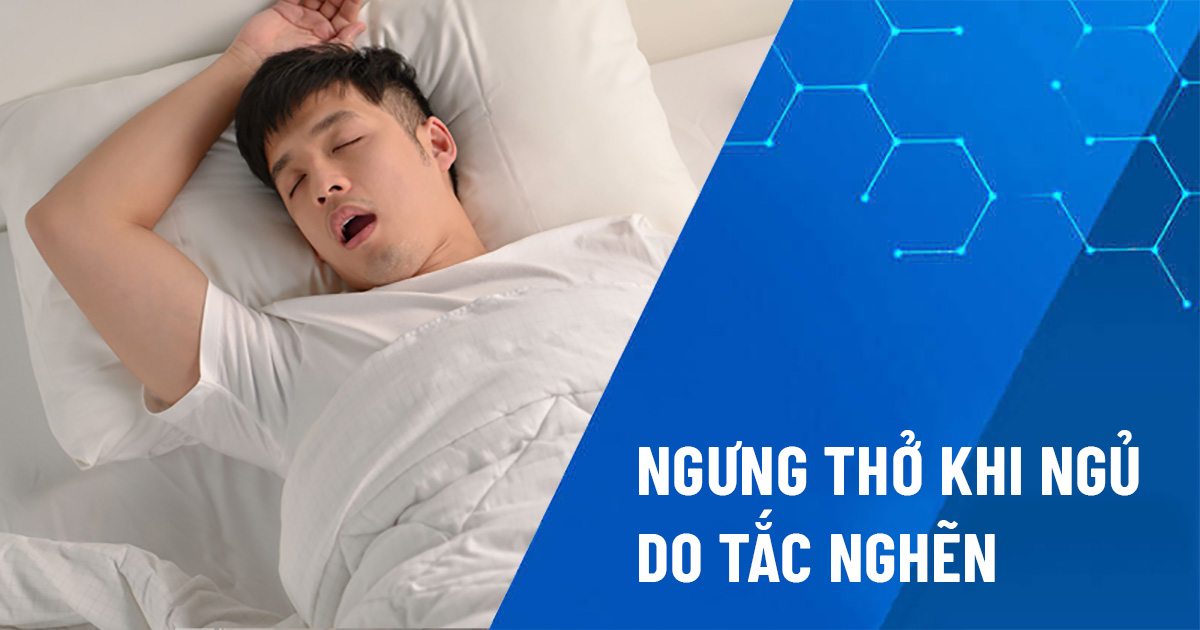 ngưng thở khi ngủ do tắc nghẽn