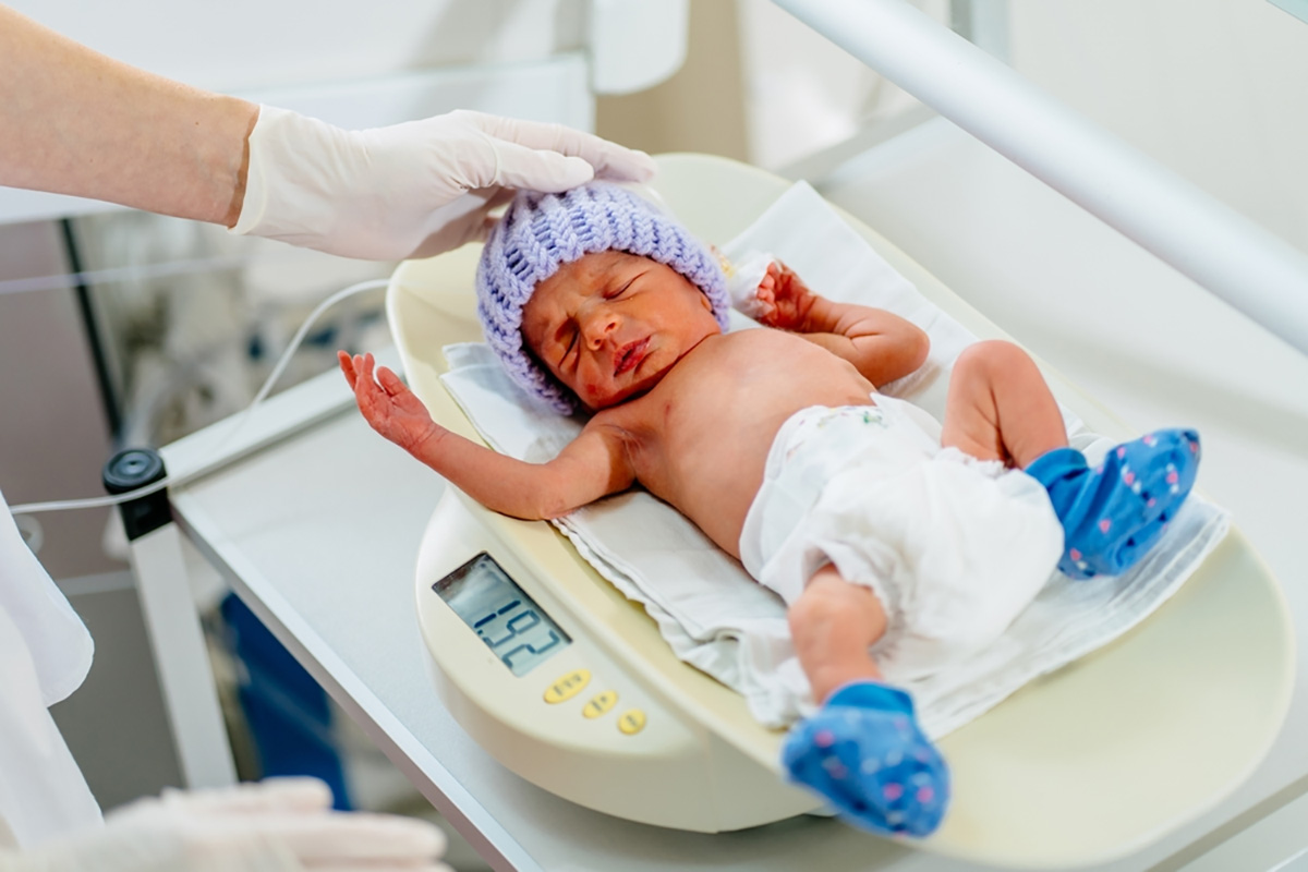 thường gặp ở trẻ sinh non và nhẹ cân